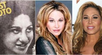 Adrienne Maloof Plastic Surgery
