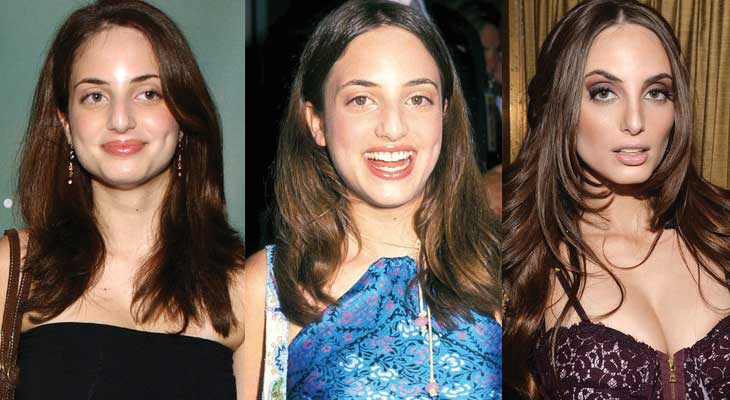Alexa Ray Joel Plastic Surgery Before and After 2022