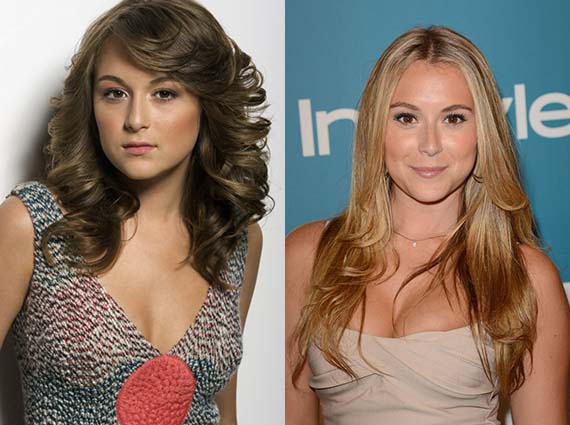 alexa vega plastic surgery