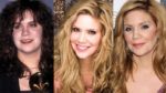 Alison Krauss Plastic Surgery