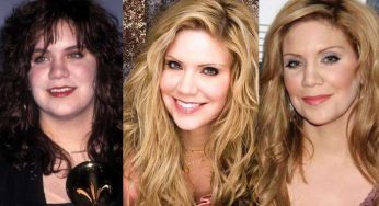 Alison Krauss Plastic Surgery