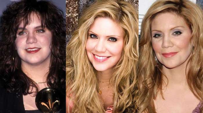 Alison Krauss Plastic Surgery Before and After 2023