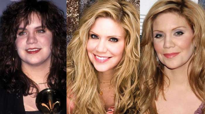 alison krauss plastic surgery