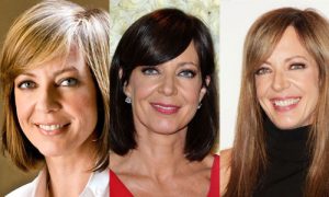 allison janney plastic surgery