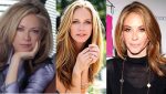 Ally Walker Plastic Surgery