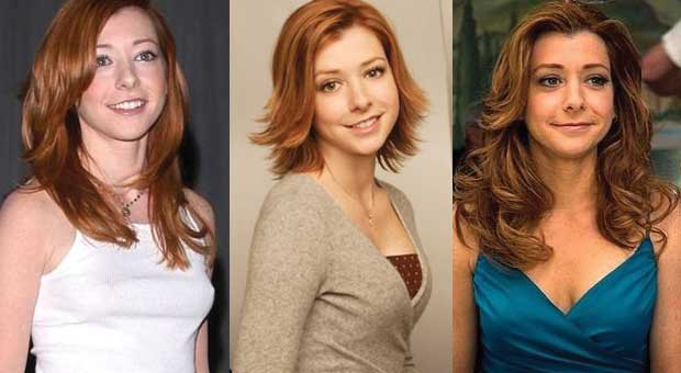 Alyson Hannigan Plastic Surgery Before and After 2023