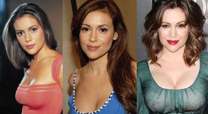 Alyssa Milano Plastic Surgery Before and After Pictures 2020.