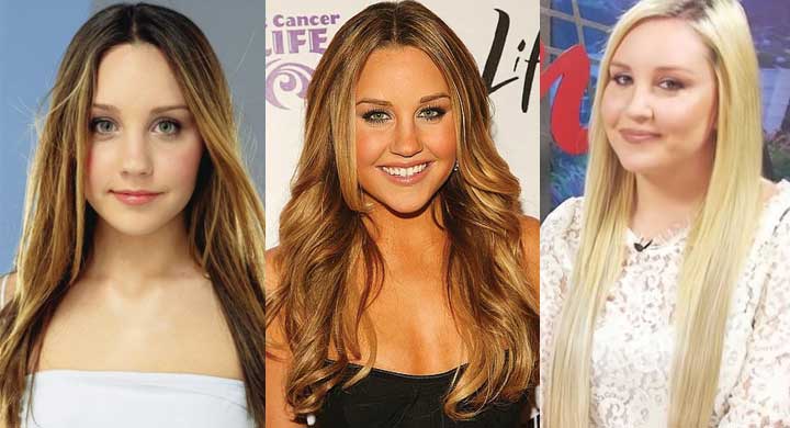 amanda bynes plastic surgery