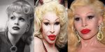 Amanda Lepore Plastic Surgery