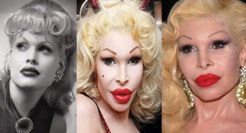 Amanda Lepore Plastic Surgery
