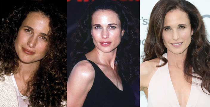 Andie Macdowell Plastic Surgery Before and After 2024
