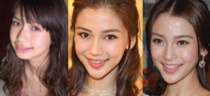 angelababy plastic surgery