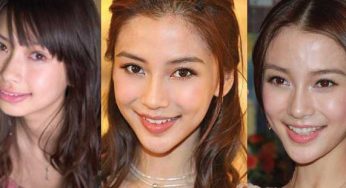 Angelababy Plastic Surgery