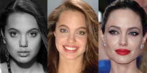 angelina jolie plastic surgery