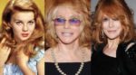 Ann Margret Plastic Surgery