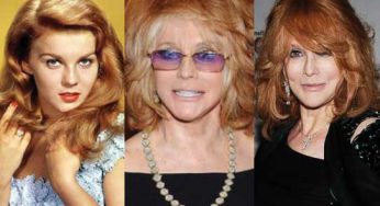 Ann Margret Plastic Surgery