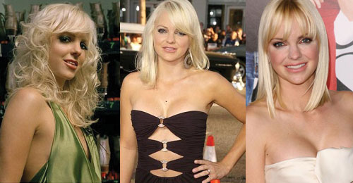 anna faris plastic surgery