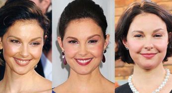 Ashley Judd Plastic Surgery