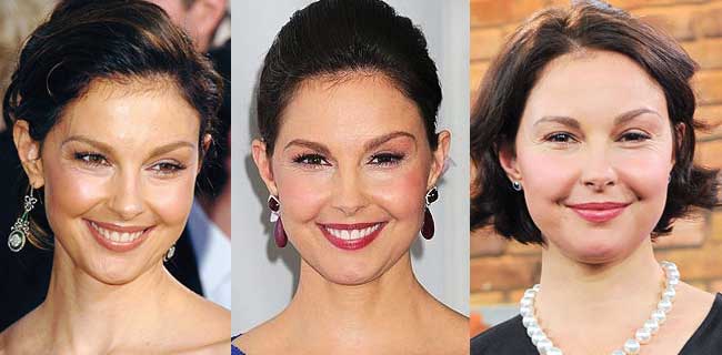 ashley judd plastic surgery