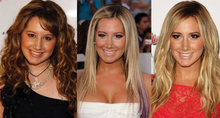 Ashley Tisdale Plastic Surgery Before and After 2024