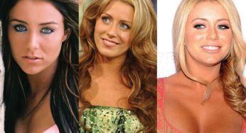 Aubrey O’Day Plastic Surgery