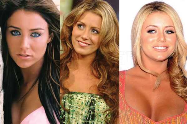 aubrey o day plastic surgery