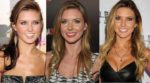 Audrina Patridge Plastic Surgery