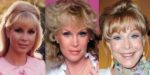 Barbara Eden Plastic Surgery