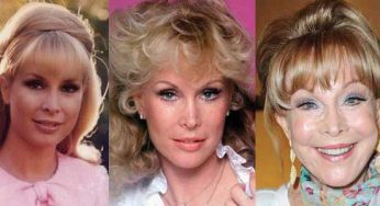 Barbara Eden Plastic Surgery