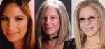 Barbra Streisand Plastic Surgery