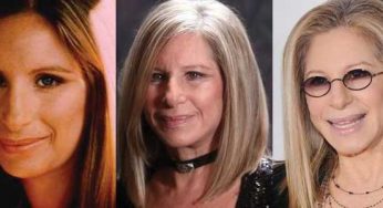 Barbra Streisand Plastic Surgery