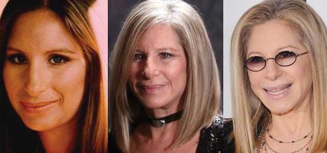 Barbra Streisand Plastic Surgery Before and After 2023