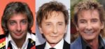 Barry Manilow Plastic Surgery