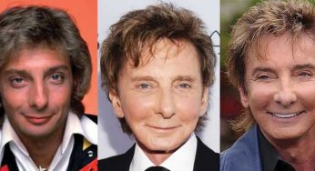 Barry Manilow Plastic Surgery