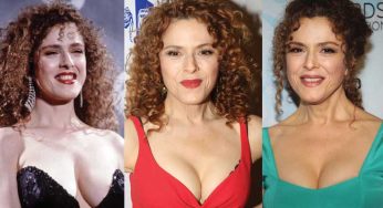 Bernadette Peters Plastic Surgery