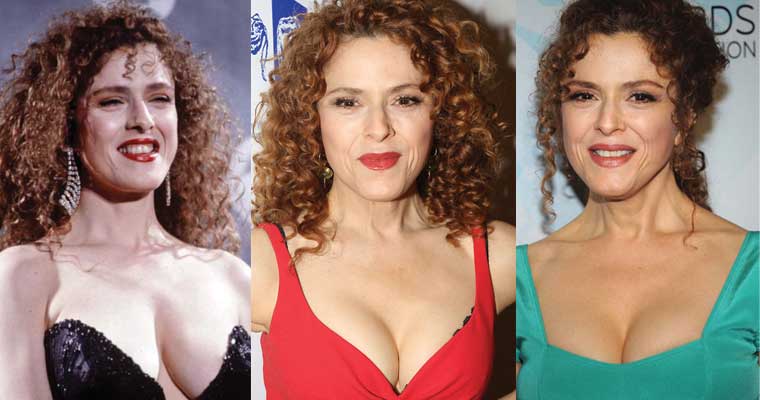 Bernadette Peters Plastic Surgery Before and After Pictures 2020.