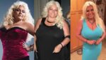 Beth Chapman Plastic Surgery