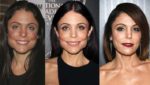 Bethenny Frankel Plastic Surgery