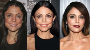 bethenny frankel plastic surgery