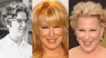 Bette Midler Plastic Surgery