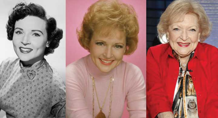 Betty White Plastic Surgery Before and After 2023