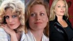 Beverly D'Angelo Plastic Surgery