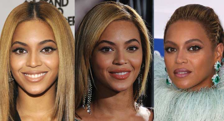 beyonce nose job before and after 2022