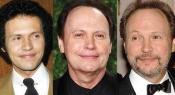 Billy Crystal Plastic Surgery
