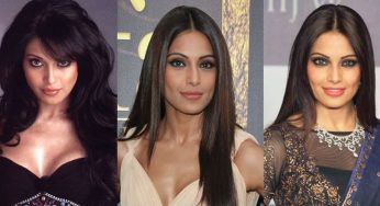 Bipasha Basu Plastic Surgery