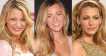 Blake Lively Plastic Surgery