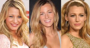 blake lively plastic surgery