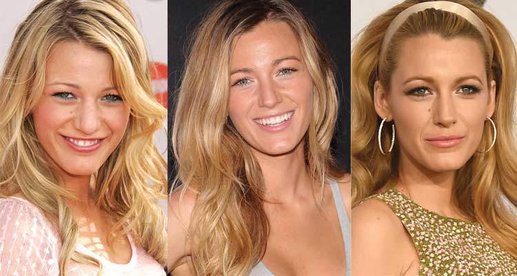 Blake Lively Plastic Surgery Before and After 2023