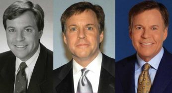 Bob Costas Plastic Surgery