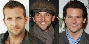 bradley cooper plastic surgery